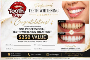Teeth whitening